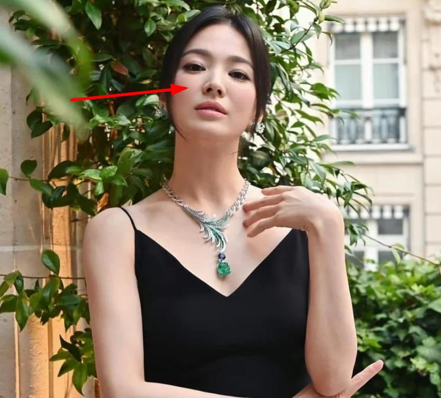 宋慧乔新剧状态分析_宋慧乔脸崩原因探讨_宋慧乔